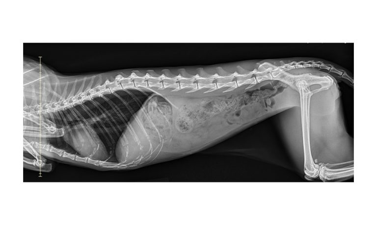 AbdomenRightLateral1of1