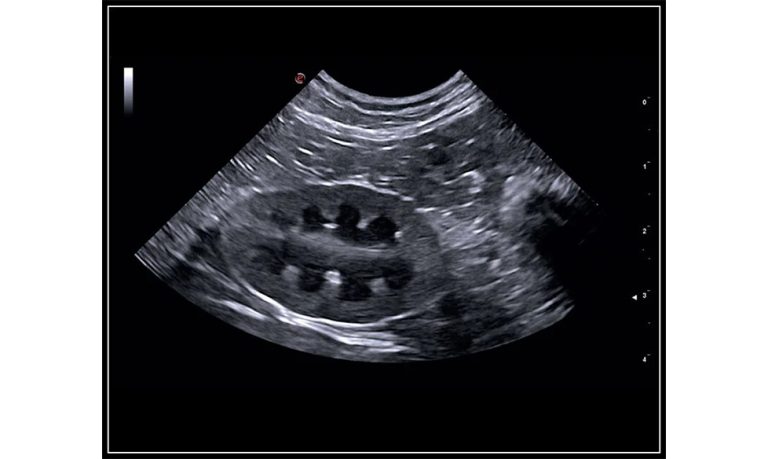 MyLabSigmaVET-Cat-Left-kidney-B-Mode