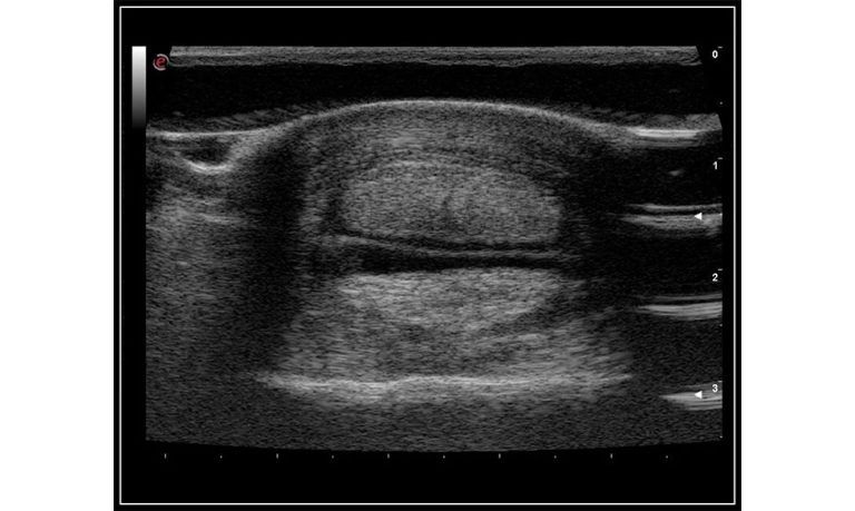 MyLabSigmaVET-Digital-tendons-B-Mode-Horse