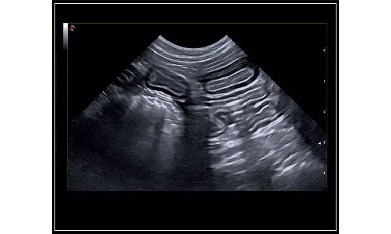 MyLabSigmaVET-Dog-IBD-B-Mode-HD-zoom